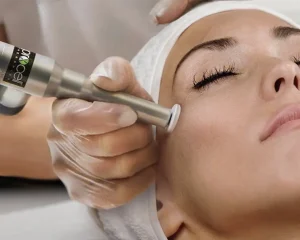 Procell Microchanneling for collagen stimulation and skin rejuvenation – Advanced skincare at Lavender Skin Therapy, Glenwood Springs.