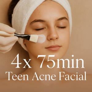 Teen Acne Facial - 4x 75 min