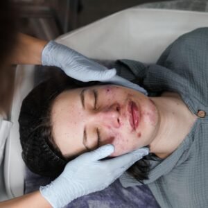 🌿 Teen Acne Facial – New Client -75 min