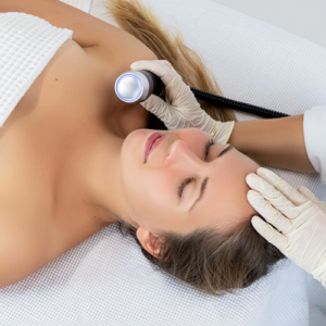 RF + CRYOTHERAPY TREATMENTS