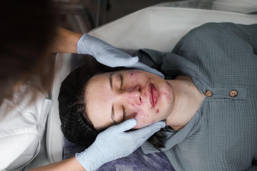 Teen receiving an acne facial from a gloved esthetician