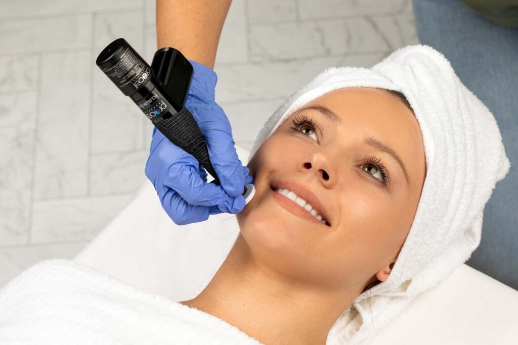 Woman with a towel on her head receiving a ProCell microchanneling treatment on her cheek